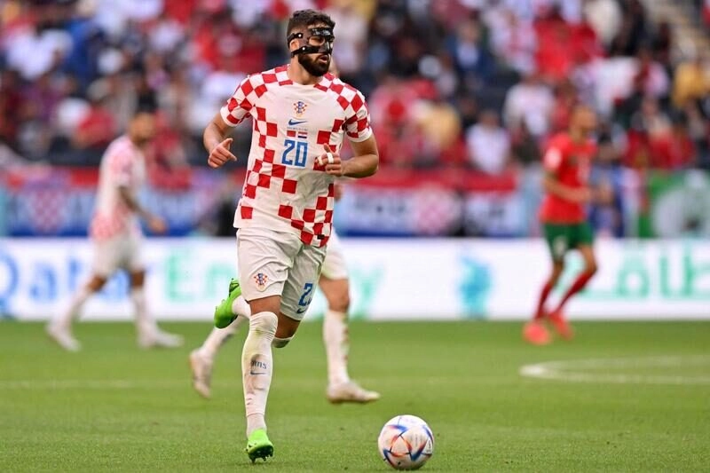 Cộng hòa Séc vs Croatia - Chờ đợi sự thay đổi